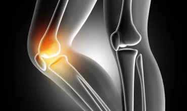 pain-knee-joint_1048-2351